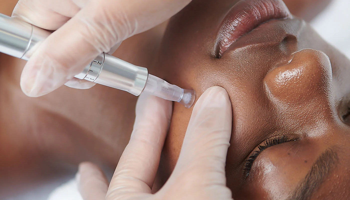 nanoneedling-seattle